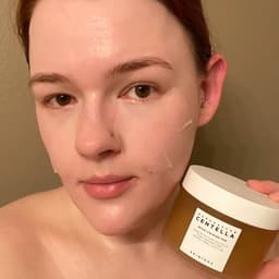 Modelo aplicando SKIN1004 Centella Quick Calming Pad sobre piel sensible con rojeces, pad coreano calmante con centella asiatica